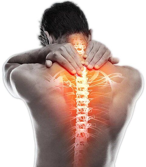 Sciatica