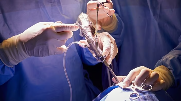 Minimally Invasive Spinal Fixation Procedure